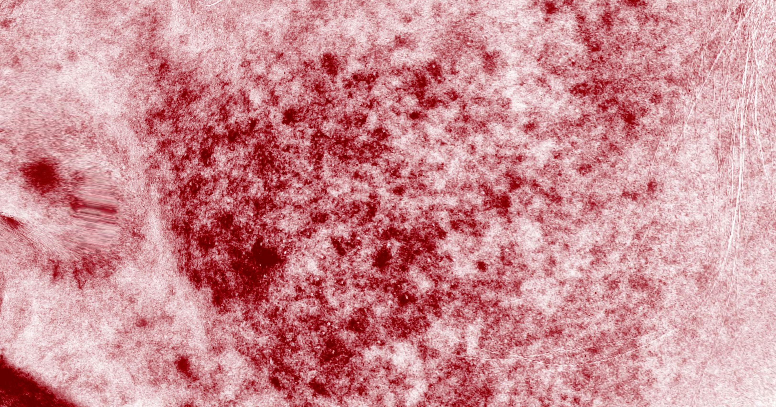 Inflammation & skin sensitivity: Enhanced red