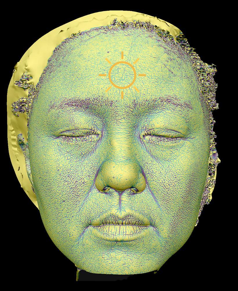 Skin condition & texture: Texture view
