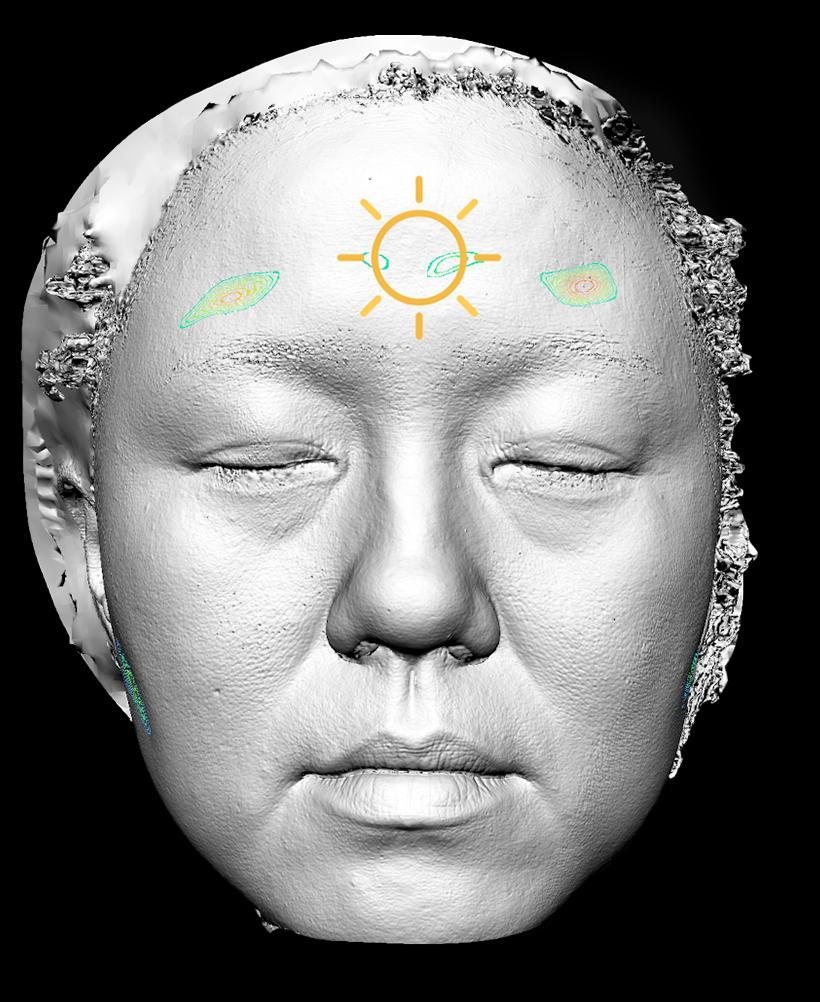 Morphological aging: Depression view